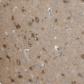 Anti-TSC22D2 antibody produced in rabbit Prestige Antibodies® Powered by Atlas Antibodies, affinity isolated antibody, buffered aqueous glycerol solution