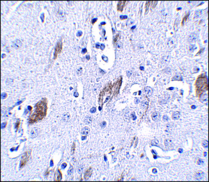 Anti-ATOH8 antibody produced in rabbit affinity isolated antibody, buffered aqueous solution