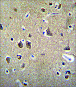 ANTI-FADS6 (C-TERM) antibody produced in rabbit IgG fraction of antiserum, buffered aqueous solution