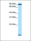 Anti-AARS antibody produced in rabbit affinity isolated antibody