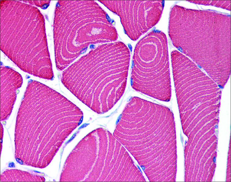 Anti-MYH7 antibody produced in rabbit affinity isolated antibody