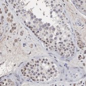 Anti-DKC1 antibody produced in rabbit Ab1, Prestige Antibodies® Powered by Atlas Antibodies, affinity isolated antibody, buffered aqueous glycerol solution