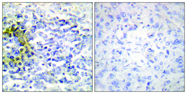 Anti-FXR2 antibody produced in rabbit affinity isolated antibody