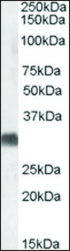 Anti-SRD5A2 (C-terminal) antibody produced in goat affinity isolated antibody, buffered aqueous solution