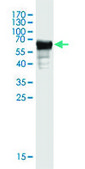 Monoclonal Anti-GLUL antibody produced in mouse clone 2B12, purified immunoglobulin, buffered aqueous solution