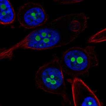 Anti-CDKN2A antibody produced in rabbit Prestige Antibodies&#174; Powered by Atlas Antibodies, affinity isolated antibody