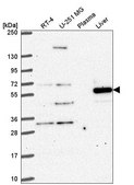 Anti-DENND6A antibody produced in rabbit Prestige Antibodies® Powered by Atlas Antibodies, affinity isolated antibody