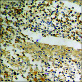 Anti-phospho-p21 Cip1 (pThr145) antibody produced in rabbit affinity isolated antibody