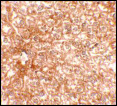 Anti-RAPGEF4 antibody produced in rabbit affinity isolated antibody