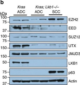 Anti-EED Antibody from rabbit