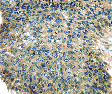 Anti-USP9X affinity isolated antibody