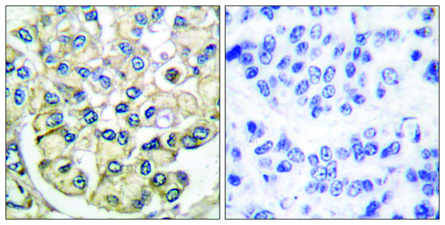 Anti-FGFR2 antibody produced in rabbit affinity isolated antibody