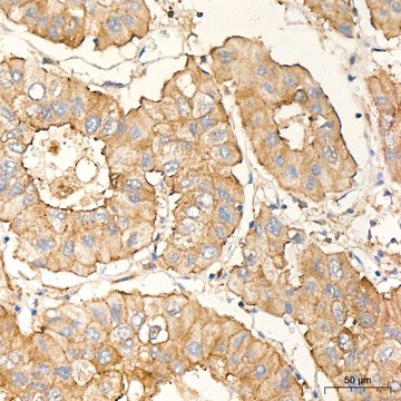 Anti-PKC alpha Antibody, clone 1G10S8, Rabbit Monoclonal