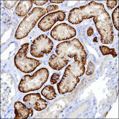 Anti-NOXA1 antibody produced in rabbit Prestige Antibodies® Powered by Atlas Antibodies, affinity isolated antibody, buffered aqueous glycerol solution