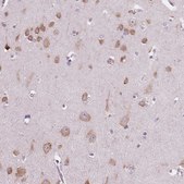 Anti-LSM14B antibody produced in rabbit Prestige Antibodies® Powered by Atlas Antibodies, affinity isolated antibody