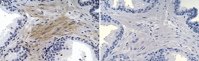 Anti-Collagen VI &#945;3 Antibody, clone 3C4 ZooMAb&#174; Mouse Monoclonal recombinant, expressed in HEK 293 cells