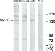 Anti-ENOS antibody produced in rabbit affinity isolated antibody