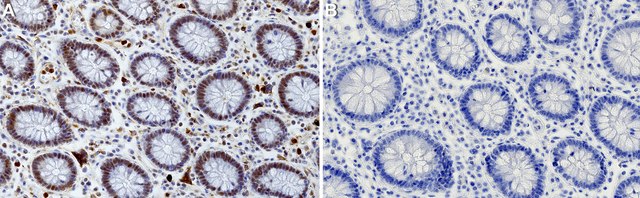 Anti-XRCC4 Antibody, clone 3I9 ZooMAb&#174; Rabbit Monoclonal recombinant, expressed in HEK 293 cells