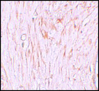 Anti-ZBTB7A antibody produced in rabbit affinity isolated antibody, buffered aqueous solution