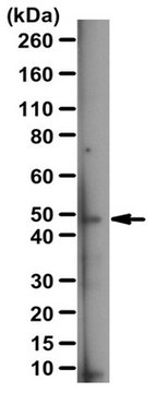 Anti-Lunapark Antibody serum, from rabbit