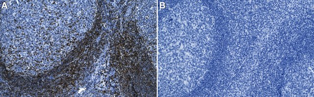 Anti-ZAP-70 Antibody, clone 1D9 ZooMAb&#174; Rabbit Monoclonal recombinant, expressed in HEK 293 cells