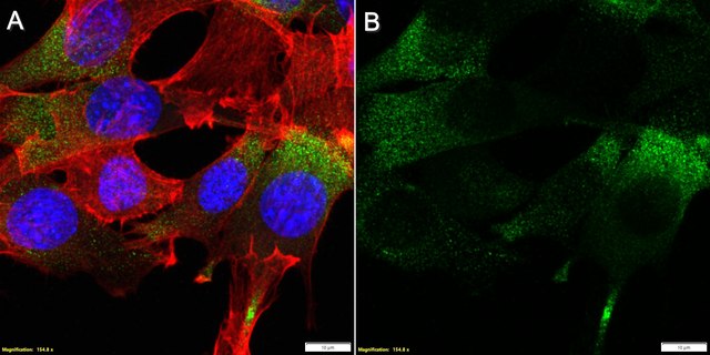 Anti-CHRNA1/ACHRA Antibody, clone 2G22 ZooMAb&#174; Rabbit Monoclonal recombinant, expressed in HEK 293 cells