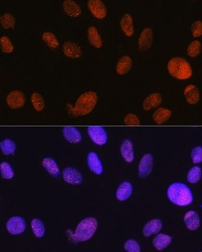 Anti-SMARCA5/SNF2H antibody produced in rabbit