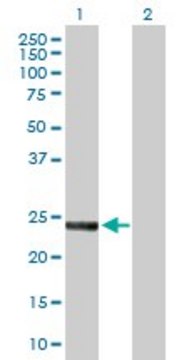 Anti-SNAP23 antibody produced in rabbit purified immunoglobulin, buffered aqueous solution