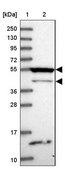 Anti-RASGEF1B antibody produced in rabbit Prestige Antibodies® Powered by Atlas Antibodies, affinity isolated antibody, buffered aqueous glycerol solution