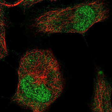 Anti-T antibody produced in rabbit affinity isolated antibody, buffered aqueous glycerol solution