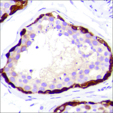 Anti-MAGE-A1 antibody, Rabbit monoclonal clone SP194, recombinant, expressed in proprietary host, affinity isolated antibody