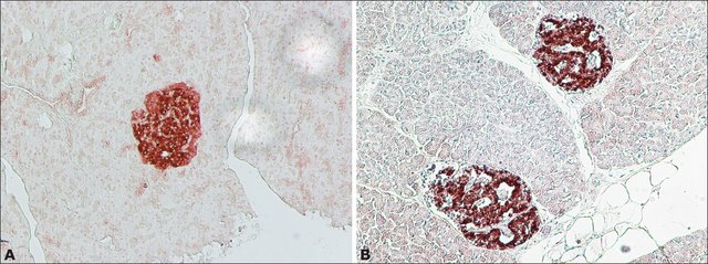 Anti-IAPP (N-terminal) antibody produced in rabbit ~1.0&#160;mg/mL, affinity isolated antibody