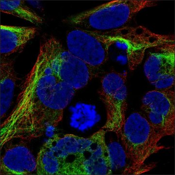 Anti-SFRP2 antibody produced in rabbit Prestige Antibodies&#174; Powered by Atlas Antibodies, affinity isolated antibody, buffered aqueous glycerol solution