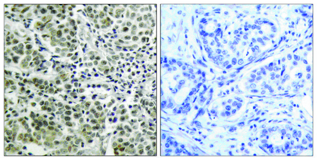 Anti-Androgen Receptor antibody produced in rabbit affinity isolated antibody