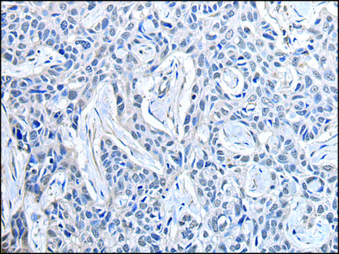 Anti-PPIG affinity isolated antibody