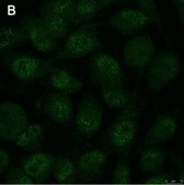 Anti-Notch1 Antibody, clone 1A32 ZooMAb® Rabbit Monoclonal recombinant, expressed in HEK 293 cells