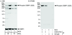 Rabbit anti-Phospho 53BP1 (S25) Antibody, Affinity Purified Powered by Bethyl Laboratories, Inc.