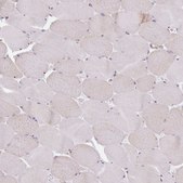 Anti-NUP85 antibody produced in rabbit Prestige Antibodies® Powered by Atlas Antibodies, affinity isolated antibody, buffered aqueous glycerol solution