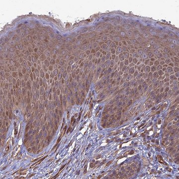 Anti-ATP6V0A2 antibody produced in rabbit Prestige Antibodies&#174; Powered by Atlas Antibodies, affinity isolated antibody, buffered aqueous glycerol solution