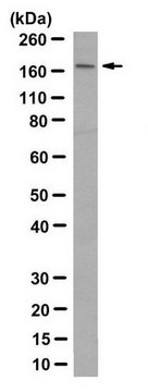 Anti-SETBP1 Antibody, clone 63 clone 63, from mouse