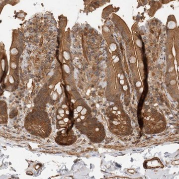 Anti-ERN1 antibody produced in rabbit Prestige Antibodies&#174; Powered by Atlas Antibodies, affinity isolated antibody, buffered aqueous glycerol solution