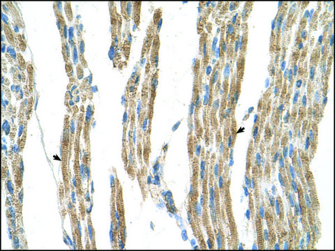 Anti-GPT (AB1) antibody produced in rabbit IgG fraction of antiserum