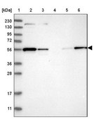 Anti-MFSD11 antibody produced in rabbit Prestige Antibodies® Powered by Atlas Antibodies, affinity isolated antibody, buffered aqueous glycerol solution