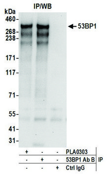 Goat anti-53BP1 Antibody, Affinity Purified Powered by Bethyl Laboratories, Inc.