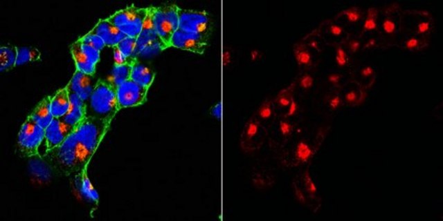 Anti-SorLA Antibody, clone 20C11 clone 20C11, from mouse