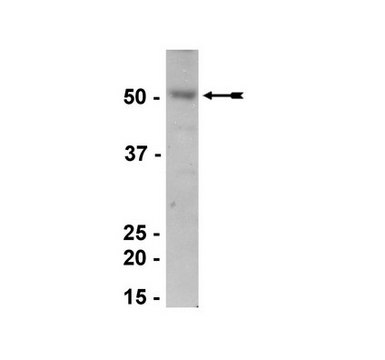 Anti-Estrogen-related Receptor &#945; Antibody Upstate&#174;, from rabbit