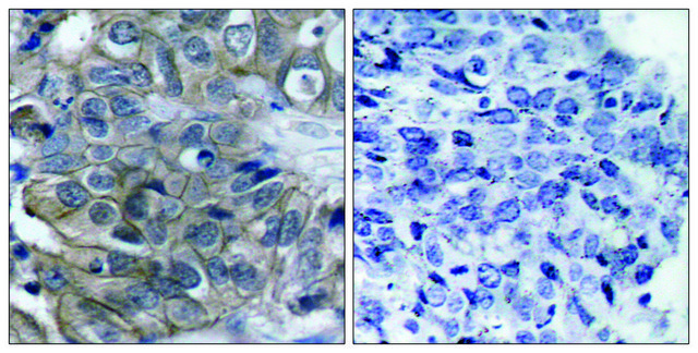 Anti-HER2 antibody produced in rabbit affinity isolated antibody