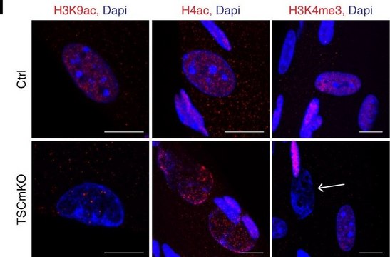 ChIPAb+ Trimethyl-Histone H3 (Lys4) - ChIP Validated Antibody and Primer Set, rabbit monoclonal from rabbit