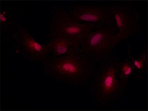 Anti-SMAD7 antibody produced in rabbit ~1.0&#160;mg/mL, affinity isolated antibody