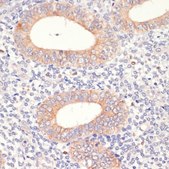 Anti-HMGCR antibody produced in rabbit